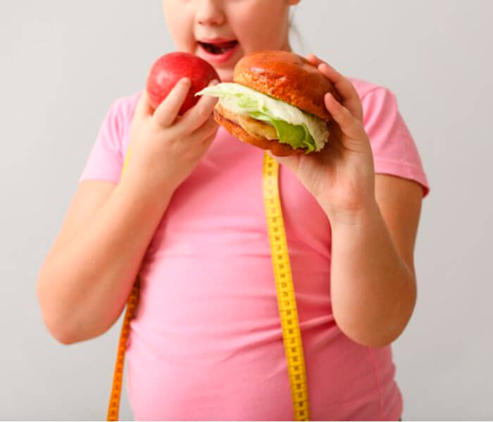 Cinco dúvidas sobre obesidade infantil